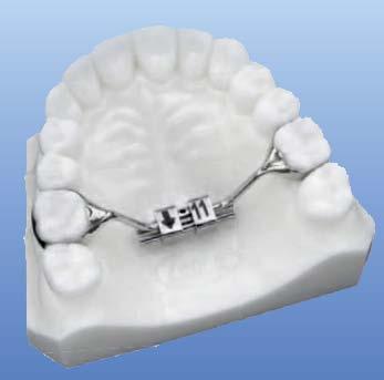 ks expandér 12 mm, expanze 10 mm, 3 pružiny, 450 g LEA2703-10 839,- 1 ks expandér 12 mm, expanze 10 mm, 3 pružiny, 900 g LEA2704-10 839,-
