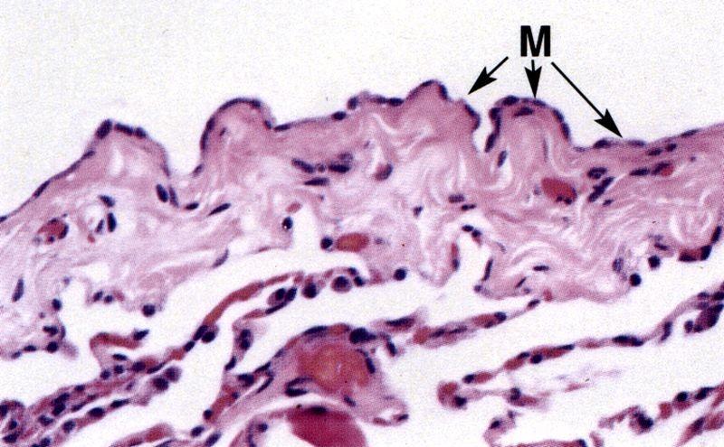 Pleura serózní membrána krytá mezotelem parietální