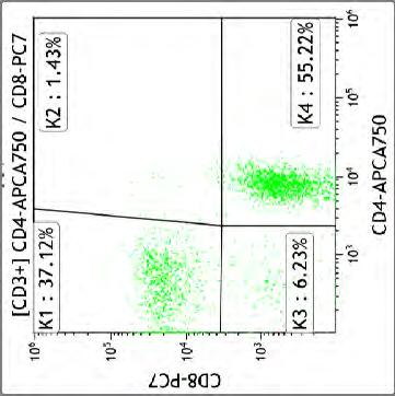 lymfocytární CD3+CD2+CD5+CD7+ s IRI = 1,5 a bez aktivace (HLADR