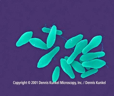 Úvod: Mikulecké pole trochu jinak Mikulecké pole hluboko zorané Nejedno Clostridium tetani v tom poli je schované V poli je schované zalezlé ve spoře Čeká až syneček nějaký