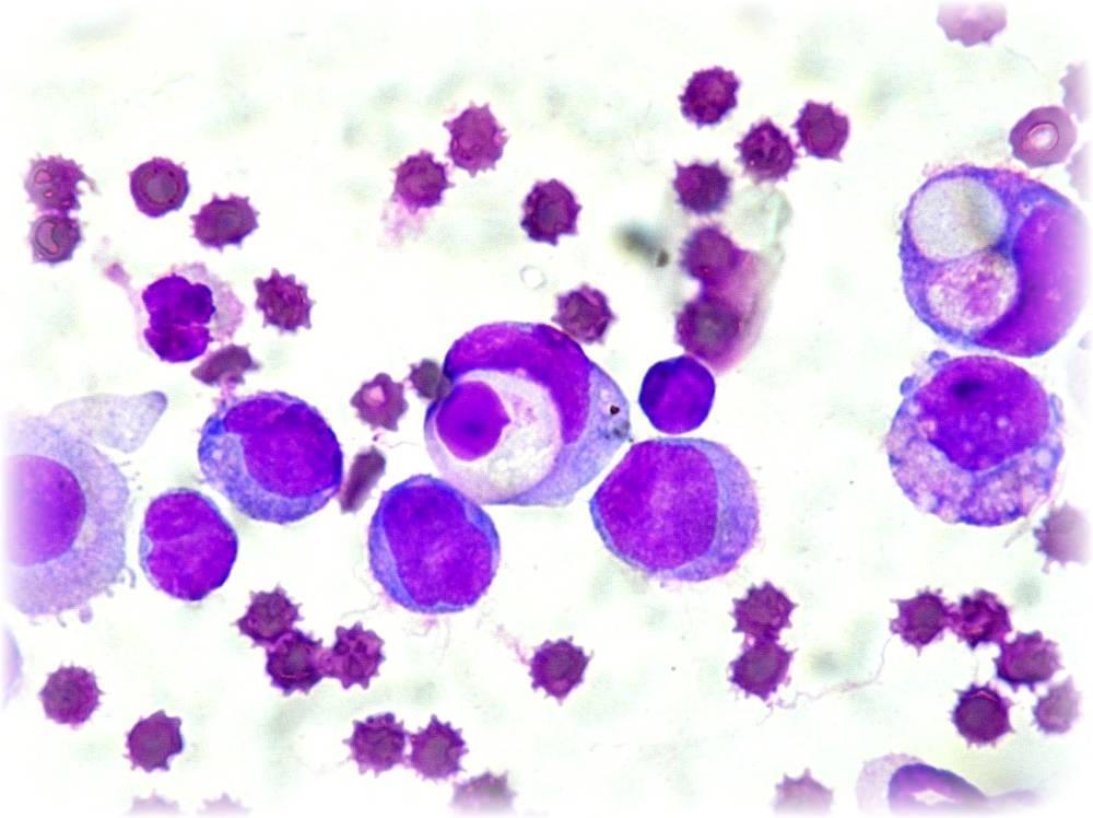 Leukocyty Leukocyty (bílé krvinky) jsou imunitní buňky. Více informací o nich naleznete v modulu Imunitní systém v této kapitole.