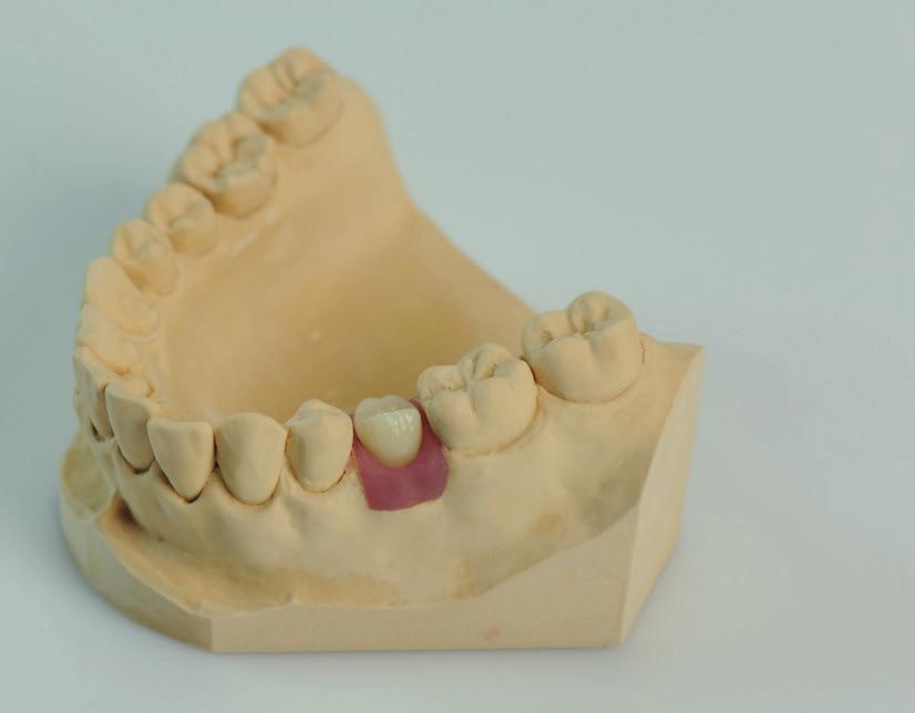 Dbejte na minimální tloušťku stěn a postupujte dle pokynů výrobce materiálu.