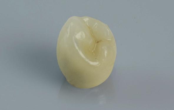 Náhrady, které je možné vytvořit: kapny, korunky, můstky, třmeny (redukované) nebo (anatomické).