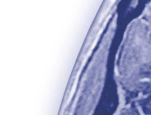 SUBKLINICKÉ AKTIVITY onemocn ní na MRI s potla ením klinických p