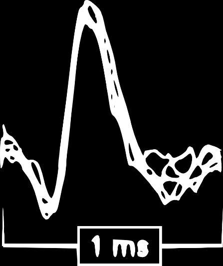 Problém neuronálního kódování čas [s] t i 1 t i t i+1 t i+2 Hodgkin & Huxley (1952): matematický model neuronu Adrian (1926): počet pulzů (AP) za zvolený čas