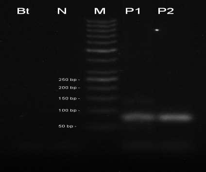 50 bp, P1 pozitivní kontrola CRM 1/2012, P2 pozitivní kontrola CRM 2/2012. Amplifikační kit REDTaq. Obr 9.