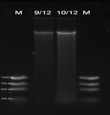 Určení kvality vyizolované DNA Obr 11.