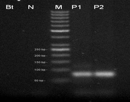 Obr 15. Stanovení transgenu MON863 (76 bp), Bt beztemplátová kontrola, N negativní kontrola CRM 2/2009, M - marker 50 bp, P1 pozitivní kontrola CRM 9/2012, P2 pozitivní kontrola CRM 10/2012.