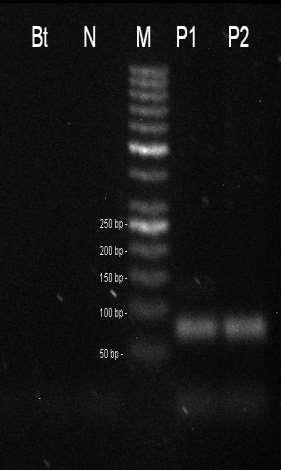 50 bp, P1 pozitivní kontrola CRM 9/2012, P2 pozitivní kontrola CRM 10/2012. Amplifikační kit REDTaq. Obr 18.