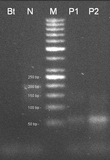 50 bp, P1 pozitivní kontrola CRM 5/2012, P2 pozitivní kontrola CRM 6/2012. Amplifikační kit REDTaq. Obr 25.