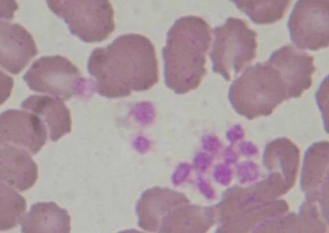 Trombocyty: krevní destičky, u savců jsou bezjaderné, jsou to vlastně odškrcené okrsky