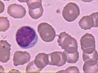 Popis formovaných krevních elementů Agranulocyty: v cytoplasmě nemají granula, jádro není