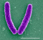 až žlutozeleně zbarvených 13 Legionella pneumophila Tyčinková bakterie, průměr 0,2 až 0,7 µm a délka 1 až 4 µ m v přírodě se vyskytují