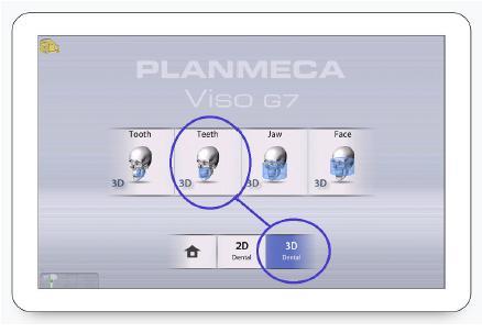 11 3D snímkování 11 3D SNÍMKOVÁNÍ 11.1 3D dentální programy 11.1.1 Přednastavené velikosti objemů PROGRAM Ø50 mm Ø100 mm Ø140 mm 1650 mm Zub Ø50 x V50 mm Zuby Ø100 x V100 mm Čelist Ø140 x V100 mm Tvář Ø140 x V160 mm 11.