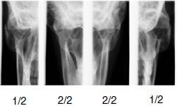 7 PROGRAMY Dvojitý PA Posterior-anterior snímkování zavřených(1/2) a otevřených (2/2) TMJ kloubů.