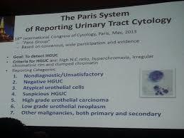 The Paris System of Reporting Urinary Tract Cytology - TPS Prezentován na 18 kongresu IAC v Paříži 2013 Diagnostické kategorie: 1.