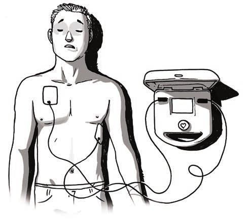 Kardiopulmonální resuscitace za použití automatického externího defibrilátoru V případech, kdy zjistíme zástavu krevního oběhu a máme k dispozici automatický externí defibrilátor (AED), doporučuje se
