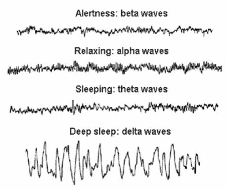 2.1.8. Delta aktivita - jsou to pomalé vlny kmitočtem okolo 3,5 Hz (viz. Obr.
