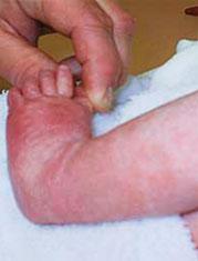 NOVÁ AUTOINFLAMATORNÍ ONEMOCNĚNÍ, INTERFERONOPATIE A MONOGENNÍ VASKULITIDY S pokračujícím výzkumem v oblasti