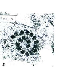 23 Ribosomy v elektronovém mikroskopu, vlevo připojené k endoplasmatickému retikulu (pohled shora), vpravo volné v cytoplasmě Typickou