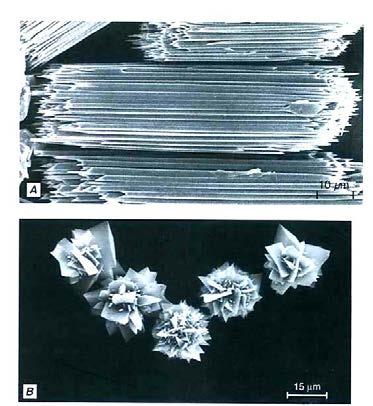 Obr. 38 Různé tvary krystalů šťavelanu vápenatého ve vakuolách 5. Hydrolytické enzymy, např. proteázy schopné rozkládat bílkoviny, nukleázy schopné rozkládat nukleové kyseliny a další.