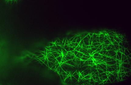 39 Buňka z pokožky huseníčku (Arabidopsis) s obarvenými vlákny cytoskeletu. Jak vzniká tělo rostliny?
