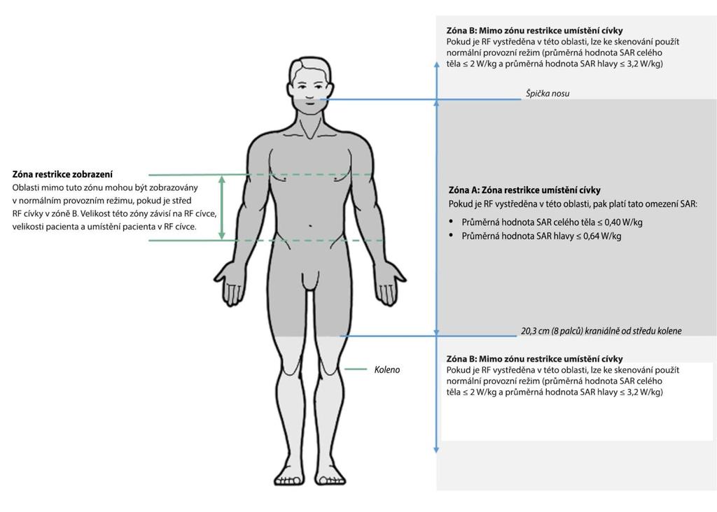 Obrázek 1: Zóna restrikce umístění cívky. Zóna restrikce umístění cívky začíná ze strany od chodidel na místě 20,3 cm (8 palců) kraniálně od středu kolene.