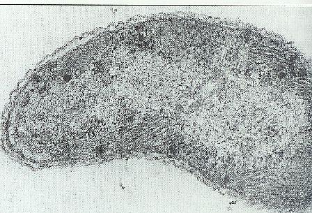 Rhodospirillum molischianum Proteobacteria Alphaproteobacteria Rhodospirillales Rhodospirillaceae Rhodospirillum Lamelární typ fotosyntetické