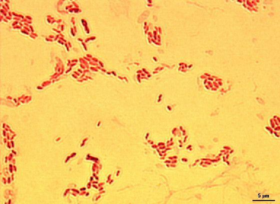 Proteobacteria Alphaproteobacteria Rhodospirillales Acetobacterace Acetobacter Acetobacter aceti Využívá se při výrobě octa ze substrátů obsahujících etanol (např.