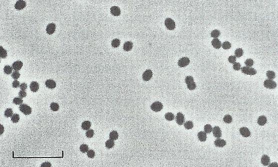 Proteobacteria Alphaproteobacteria Nitrosomonadales Nitrosomonadaceae Nitrosomonas 1 μm N.