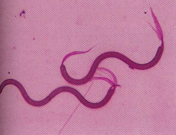 Proteobacteria Alphaproteobacteria Nitrosomonadales Spirillaceae Spirillum Helikální buňky (průměr 1,4 až 1,7 mm a délka 14 až 60 mm), zásobní látka jsou poly-ß-hydroxybutyrátová granula.