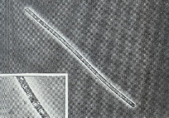 Proteobacteria Gammaproteobacteria Thiotrichales Thiotrichaceae Beggiatoa Inkluze síry B.