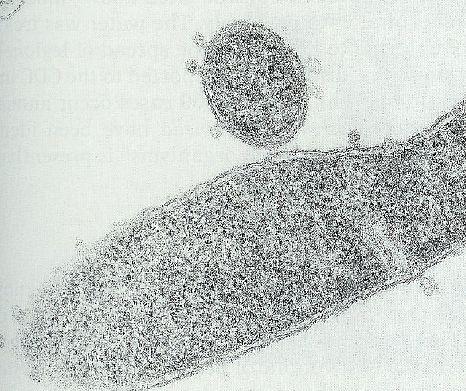Proteobacteria Gammaproteobacteria Legionellales Legionellaceae Legionella Buňka ameby L.