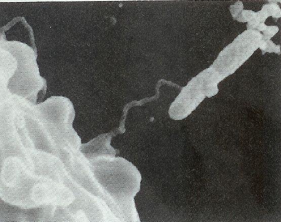 Aerobní, chemoorganotrofní. Izolovány z povrchové vody, bahna, z termálních jezer a říček (i znečištěných).