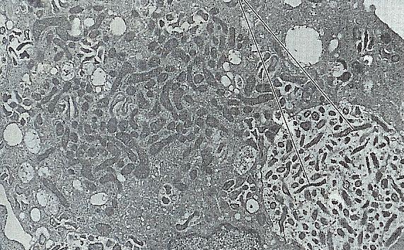 Proteobacteria Gammaproteobacteria Legionellales Coxiellaceae Coxiella Krátké tyčky podobné ricketsiím. Přednostní růst ve vakuolách hostitelské buňky.