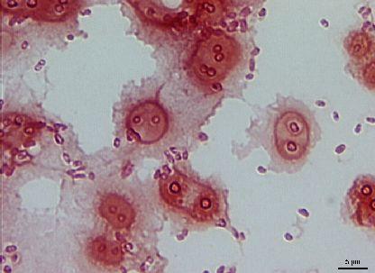 Proteobacteria Gammaproteobacteria Pseudomonadales Pseudomonadaceae Azotobacter pouzdra A.