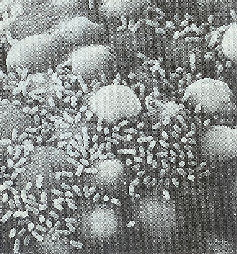 Proteobacteria Gammaproteobacteria Enterobacteriales Enterobacteriaceae Escherichia Buňky mají tvar rovné tyčky vyskytující se jednotlivě.