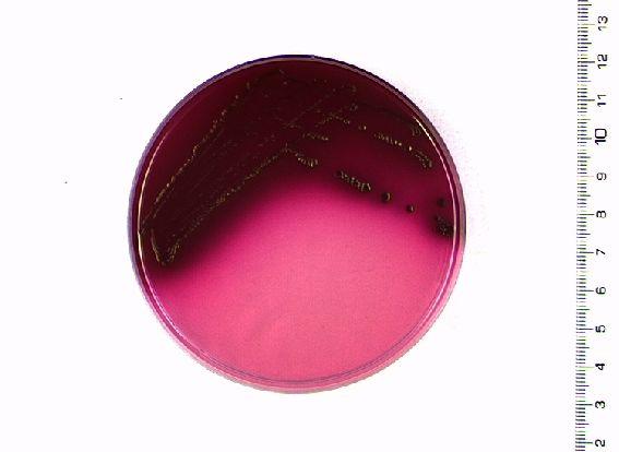Mají jak respiratorní, tak i fermentatorní typ metabolismu. Vyskytují se jako normální flóra v koncové části střevního traktu teplokrevných živočichů (v případě E blattae i švábů). y E.