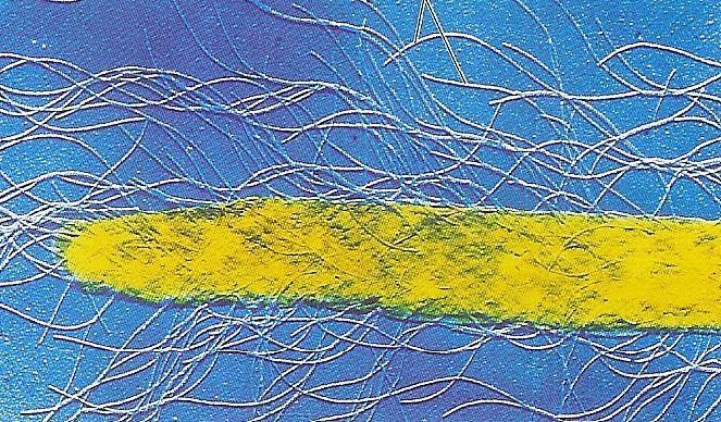 Proteobacteria Gammaproteobacteria Enterobacteriales Enterobacteriaceae Proteus G- rovné tyčky, pohyblivé peritrichálními bičíky. Fakultativně anaerobní a chemoorganotrofní.