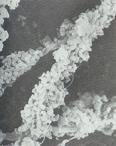 S. enterica subsp. enterica sv.