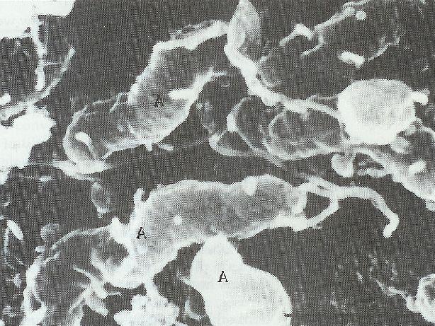bičík Proteobacteria Epsilonproteobacteria Campylobacterales Helicobacteraceae Helicobacter