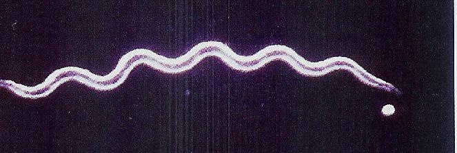 Spirochaetes Spirochaetes Spirochaetales Spirochaetaceae Borrelia Ixodes damnini B.