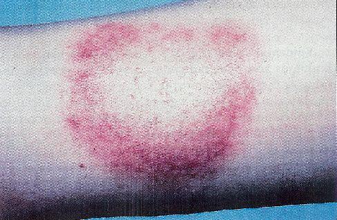 až 10 volných smyček. Buňky jsou pohyblivé pomocí 7 až 30 axiálních bičíků. Chemoorganotrofní, mikroaerofilní.