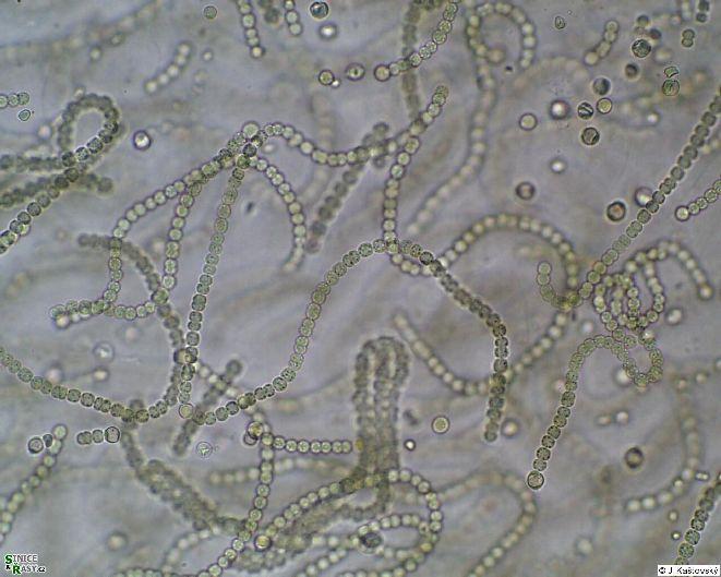 heterocyty Cyanobacteria Cyanobacteria Pododdělení IV.