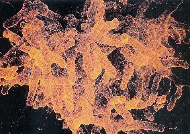 Bakterie s buněčnou stěnou grampozitivního typu Actinobacteria Actinobacteria Actinomycetales Actinomycetaceae Actinomyces Rovné, mírně zakřivené tyčky až štíhlá vlákna, která se větví.