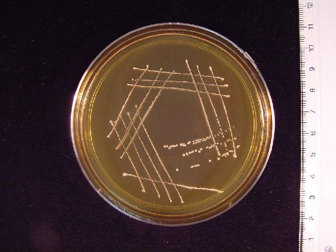 Jsou nepohyblivé, nesporulující, fakultativně anaerobní s variabilní aereotolerancí. Chemoorganotrofní. P. freudenreichii Druhy ze sýrů či jiných mléčných výrobků P.