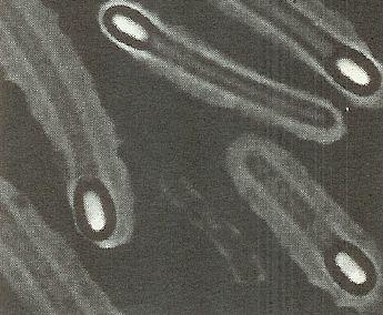 perfringens produkuje řadu toxinů vyskytuje se v půdě, střevním traktu živočichů včetně člověka. Způsobuje asi 80% případů klostridiové myonekrózy (plynové gangrény).
