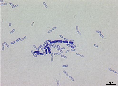 Bakterie s buněčnou stěnou grampozitivního typu Firmicutes Bacilli Bacillales Bacillaceae Bacillus Buňky jsou
