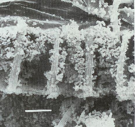 Bakterie s buněčnou stěnou grampozitivního typu Firmicutes Bacilli L. mesenteroides subsp.