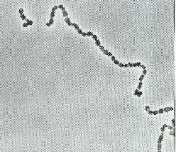 Bakterie s buněčnou stěnou grampozitivního typu Streptococcus pyogenes β-hemolýza Firmicutes Bacilli Lactobacillales Streptococcaceae Streptococcus Buňky sférické nebo